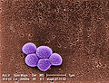 Staph has evolved into the Superbug known as MRSA.
