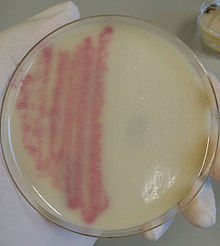 MRSA on a choromogenic media plate.