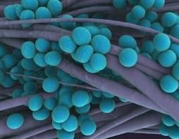 Microbes evolve faster than Antibiotics.